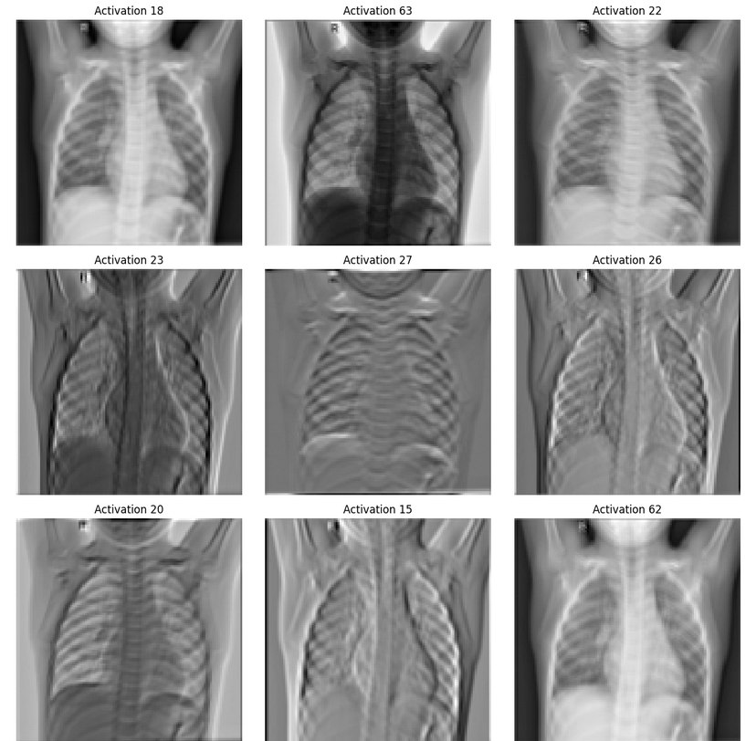 X-Ray Pneumonia Diagnosis GitHub Repository